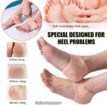pair-of-half-heel-pain-anti-crack-silicone-set-anti-crack-for-pain-relief-unisex – 1