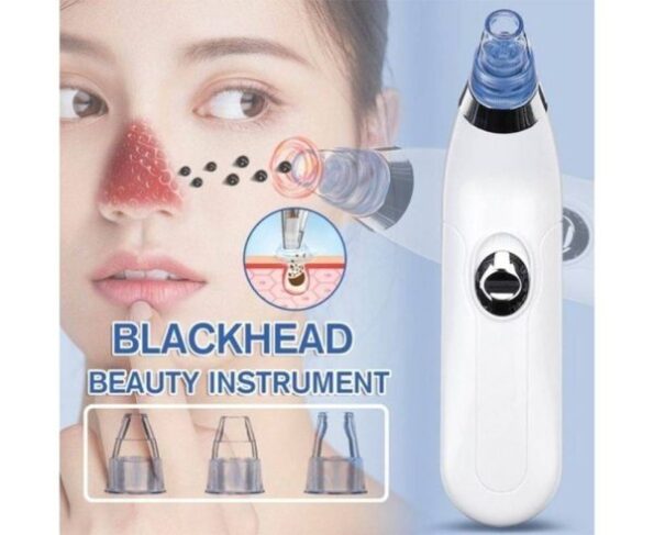 Blackhead Removal Machine-derma Suction 4 In 1 Black Head Remover Machine - Image 2