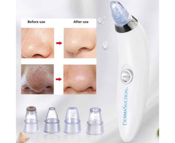 Blackhead Removal Machine-derma Suction 4 In 1 Black Head Remover Machine - Image 8