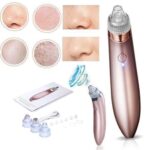 blackhead remover