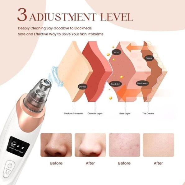 Blackhead Remover Pore Vacuum Black Spot Suction Electric Facial Pore Cleaner 5 Blackhead Remover Pore Vacuum Black Spot Suction Electric Facial Pore Cleaner - Image 5