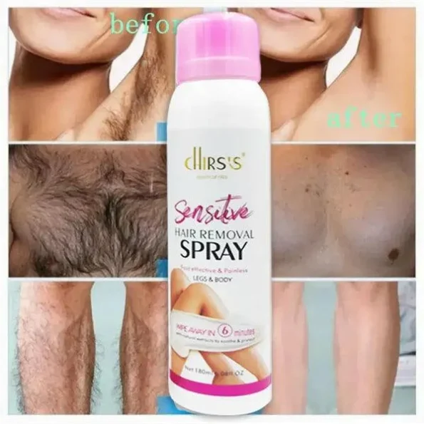 Chirs’s Fast Effective & Painless Hair Removal Spray For Legs & Body - Image 3
