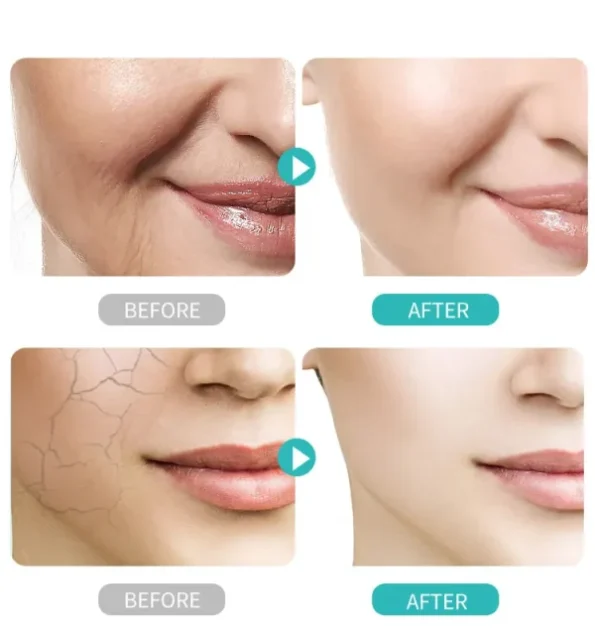 Estelin Hyaluronic Acid Hydrating & Vitalizing Skin Care Set – 7 Pcs Set 3 Estelin Hyaluronic Acid Hydrating & Vitalizing Skin Care Set – 7 Pcs Set - Image 3