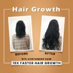 ultra-blend-hair-diet-oil-for-the-repair-of-hair-growth-hair-loss-200ml – 1